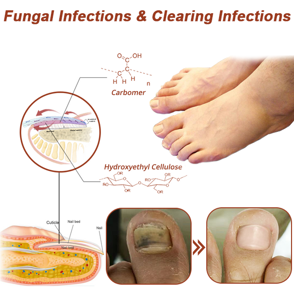 Fivfivgo™ Revolutionary light therapy for toenail disorders - Effortless results!