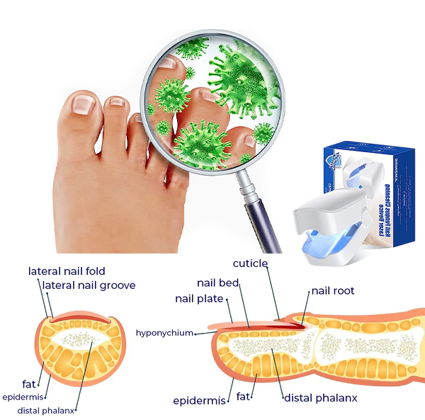 Fivfivgo™ Revolutionary light therapy for toenail disorders - Effortless results!