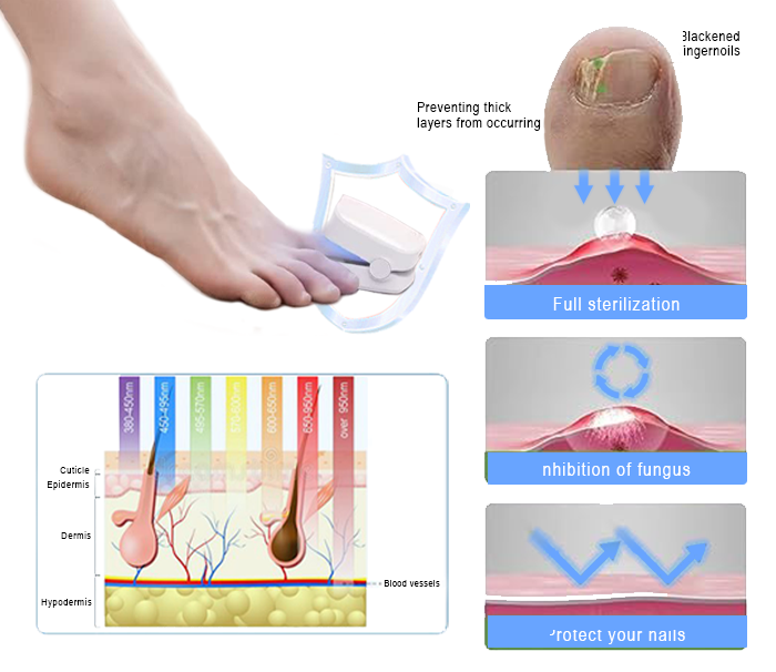 Fivfivgo™ Revolutionary light therapy for toenail disorders - Effortless results!