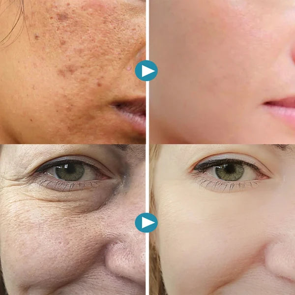 Age-Defying Elixir™ Line and Wrinkle Reducer | Youthful Skin at Your Fingertips (1+2 Free)