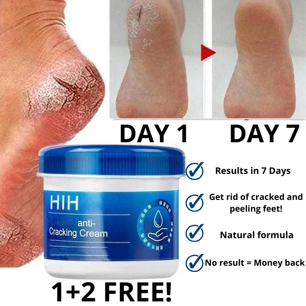 FootBliss™ Moisturizing Cream - Say goodbye to cracked feet (1+2 Free)