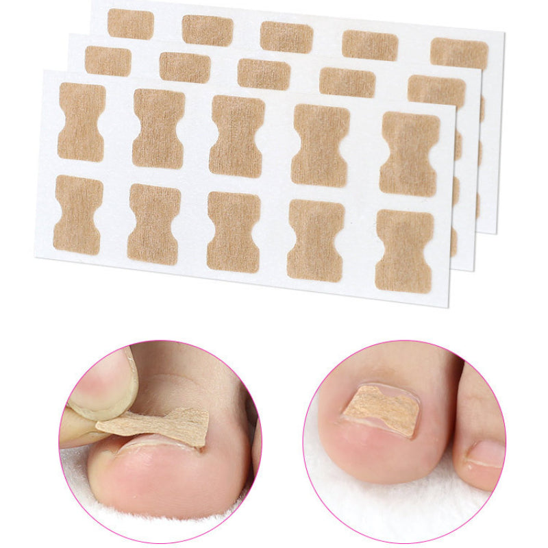 EasyPatches™ Cure Ingrown Toenails & Nail Fungus! Fast, Effective & Painless