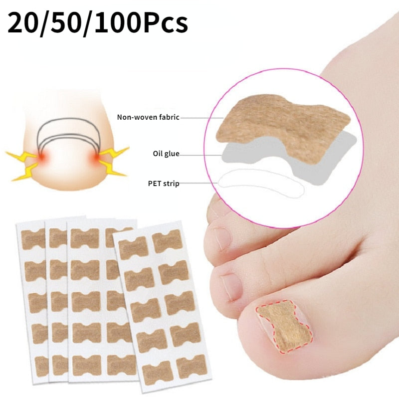 EasyPatches™ Cure Ingrown Toenails & Nail Fungus! Fast, Effective & Painless